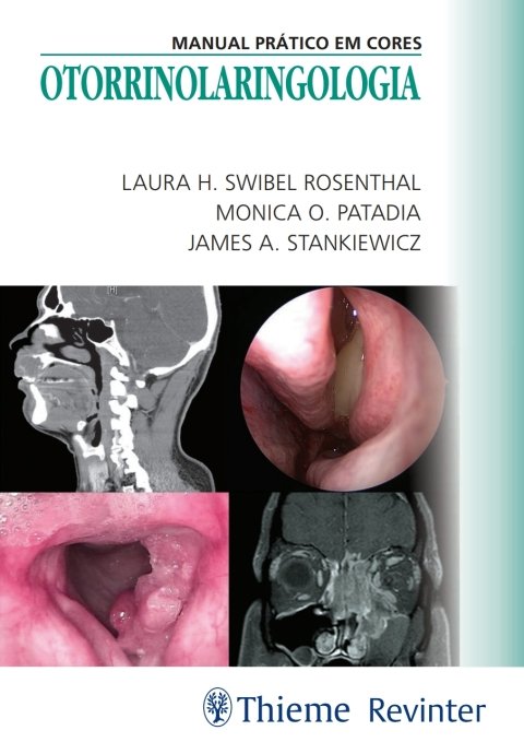 Otorrinolaringologia manual prático em cores