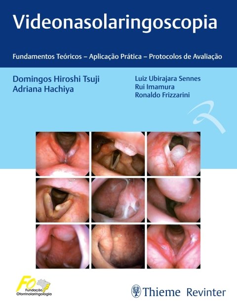 Videonasolaringoscopia fundamentos teóricos aplicação prática protocolos de avaliação
