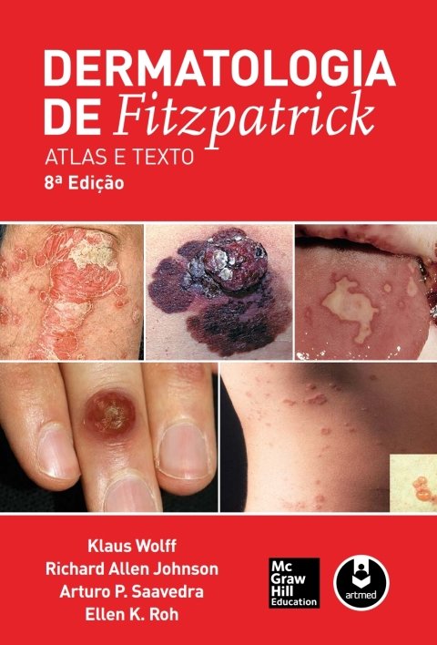 Dermatologia de Fitzpatrick atlas e texto