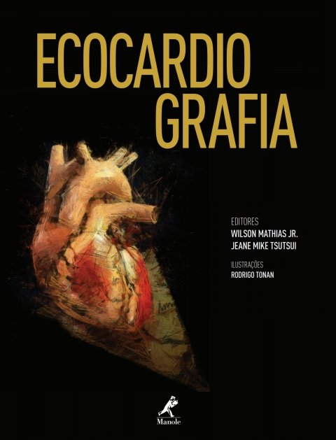 Ecocardiografia