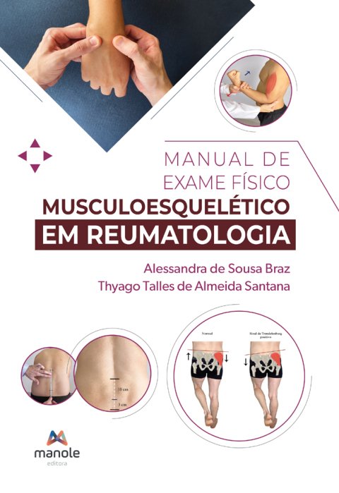 Manual de exame físico musculoesquelético em reumatologia