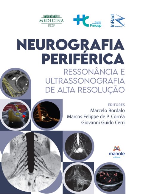 Neurografia periférica ressonância e ultrassonografia de alta resolução