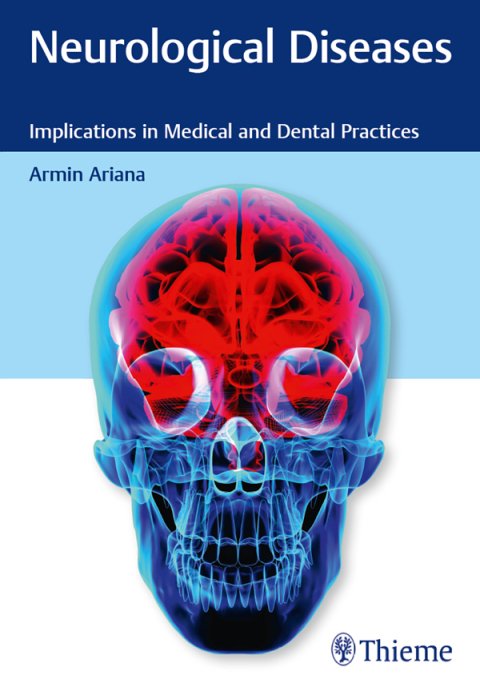 Neurological diseases Implications in Medical and Dental Practices