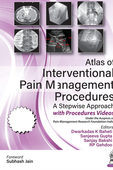 Atlas of Interventional pain management procedures: a stepwise approach