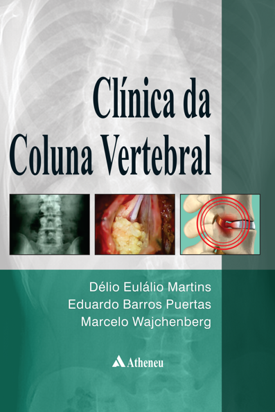 Clínica da coluna vertebral