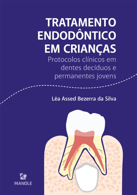 Tratamento endodôntico em crianças