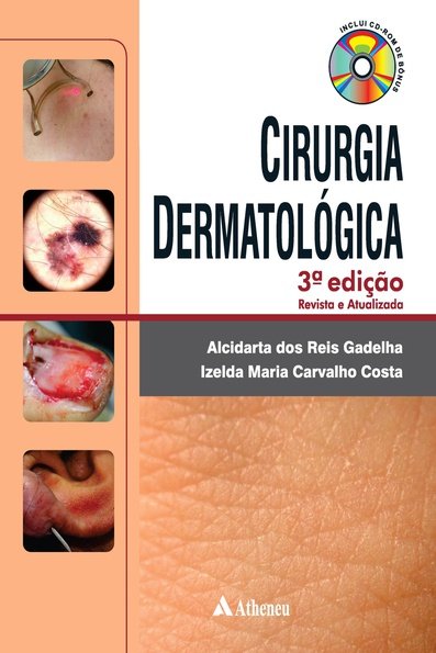 Cirurgia dermatológica