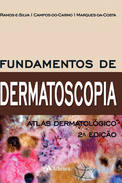 Fundamentos de dermatoscopia