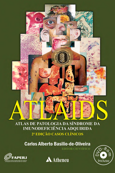 ATLAIDS: atlas de patologia da síndrome da imunodeficiência adquirida (AID...