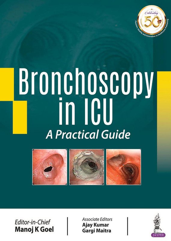 Bronchoscopy in ICU