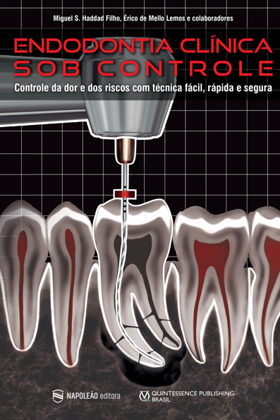 Endodontia Clínica sob Controle
