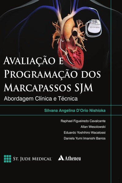 Avaliação e programação dos marcapassos SJM