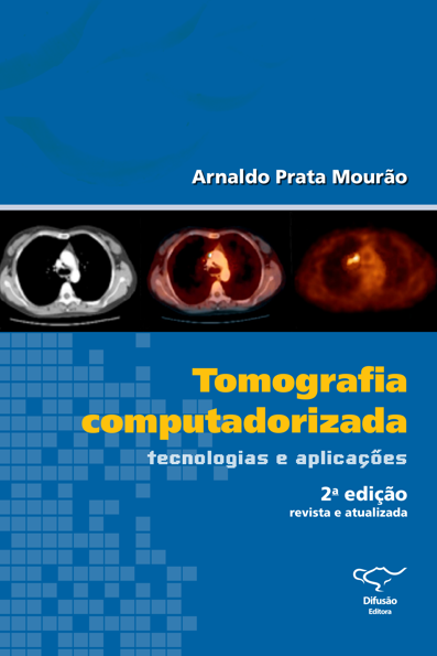 Tomografia computadorizada: tecnologias e aplicações