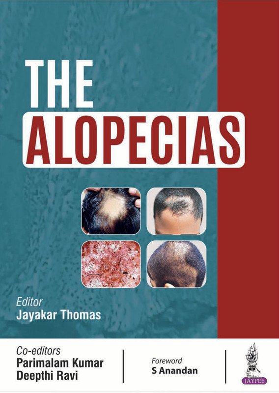 The Alopecias