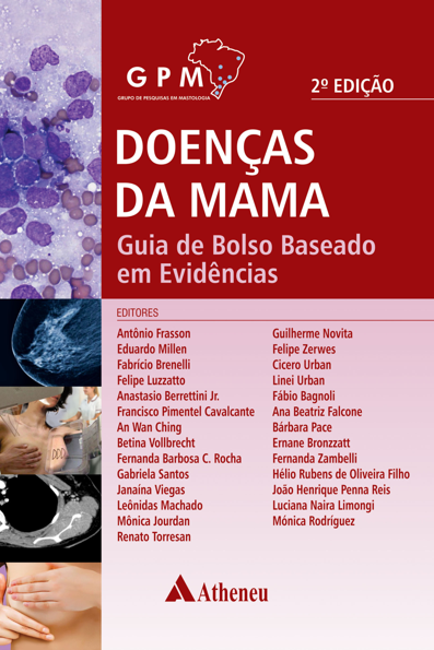 Doenças da mama: guia de bolso baseado em evidências