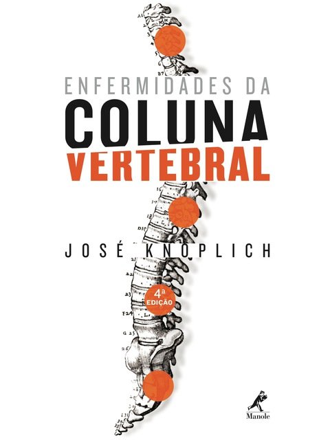 Enfermidades da coluna vertebral