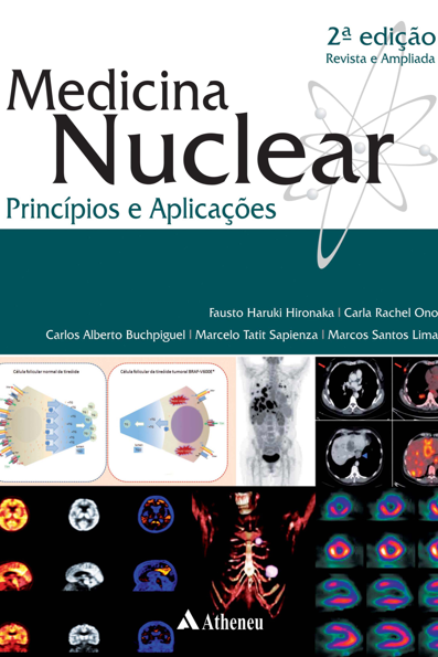 Medicina nuclear: princípios e aplicações