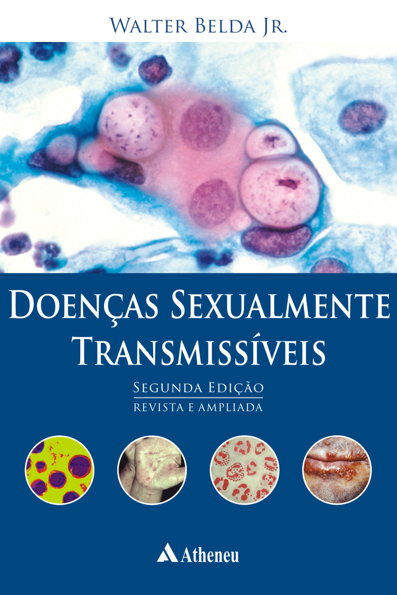 Doenças sexualmente transmissíveis