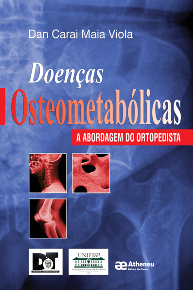 Doenças osteometabólicas