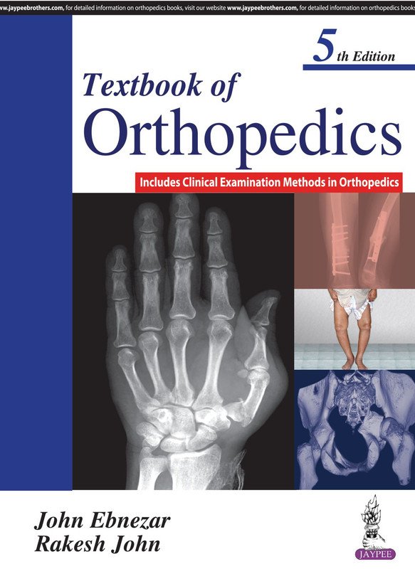 Textbook of Orthopedics