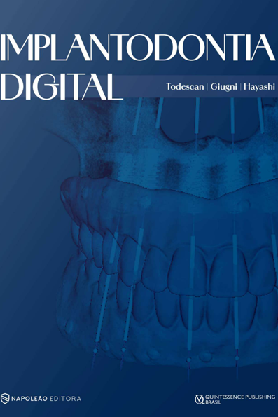 Implantodontia digital