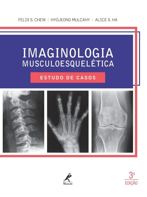 Imaginologia musculoesquelética