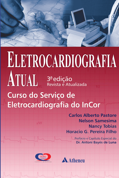 Eletrocardiografia atual