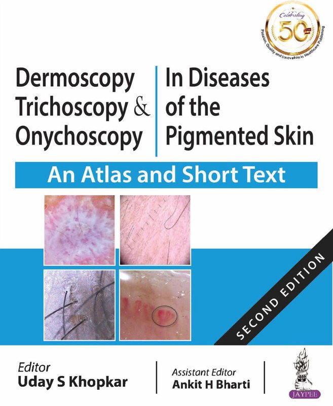 Dermoscopy, Trichoscopy & Onychoscopy in Diseases of the Pigmented Skin