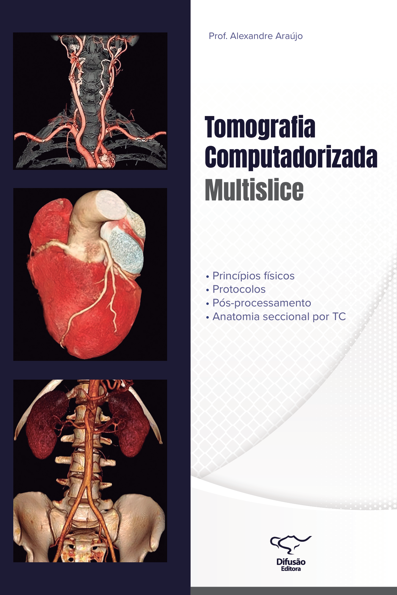 Tomografia computadorizada multislice: princípios físicos protocolos, pós