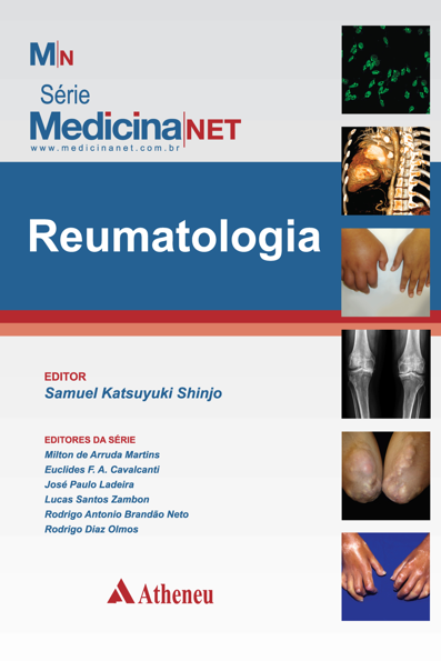 Reumatologia