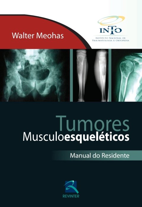 Tumores musculoesqueléticos
