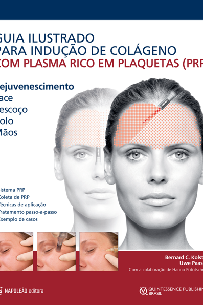 Guia ilustrado para indução de colágeno com plasma rico em plaquetas (PRP)