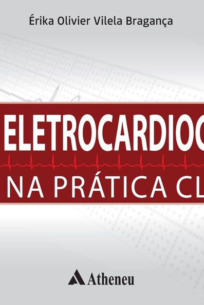Eletrocardiograma na prática clínica