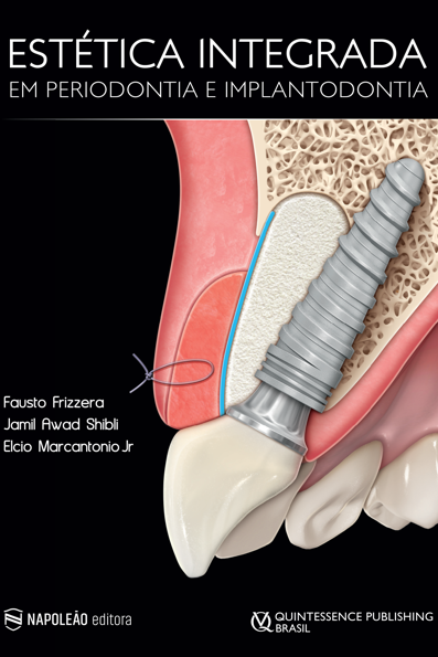 Estética integrada em periodontia e implantodontia