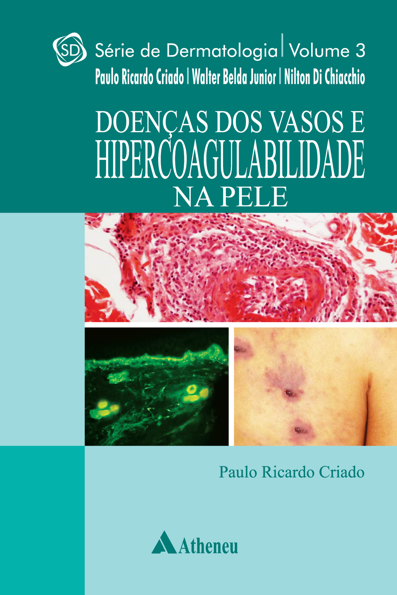 Doenças dos vasos e hipercoagulabilidade na pele