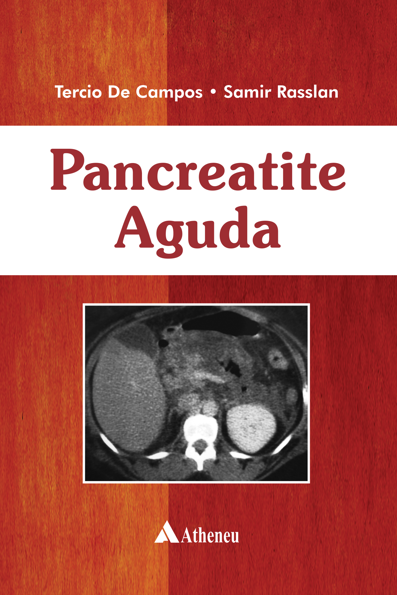 Pancreatite aguda