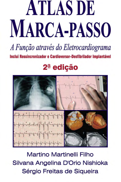 Atlas de marca passo: a função através do eletrocardiograma