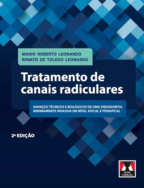 Tratamento de canais radiculares